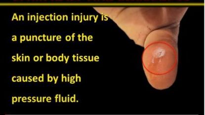 Picture of Online Safety Training-Fluid Injection Injury (access code will be e-mailed)